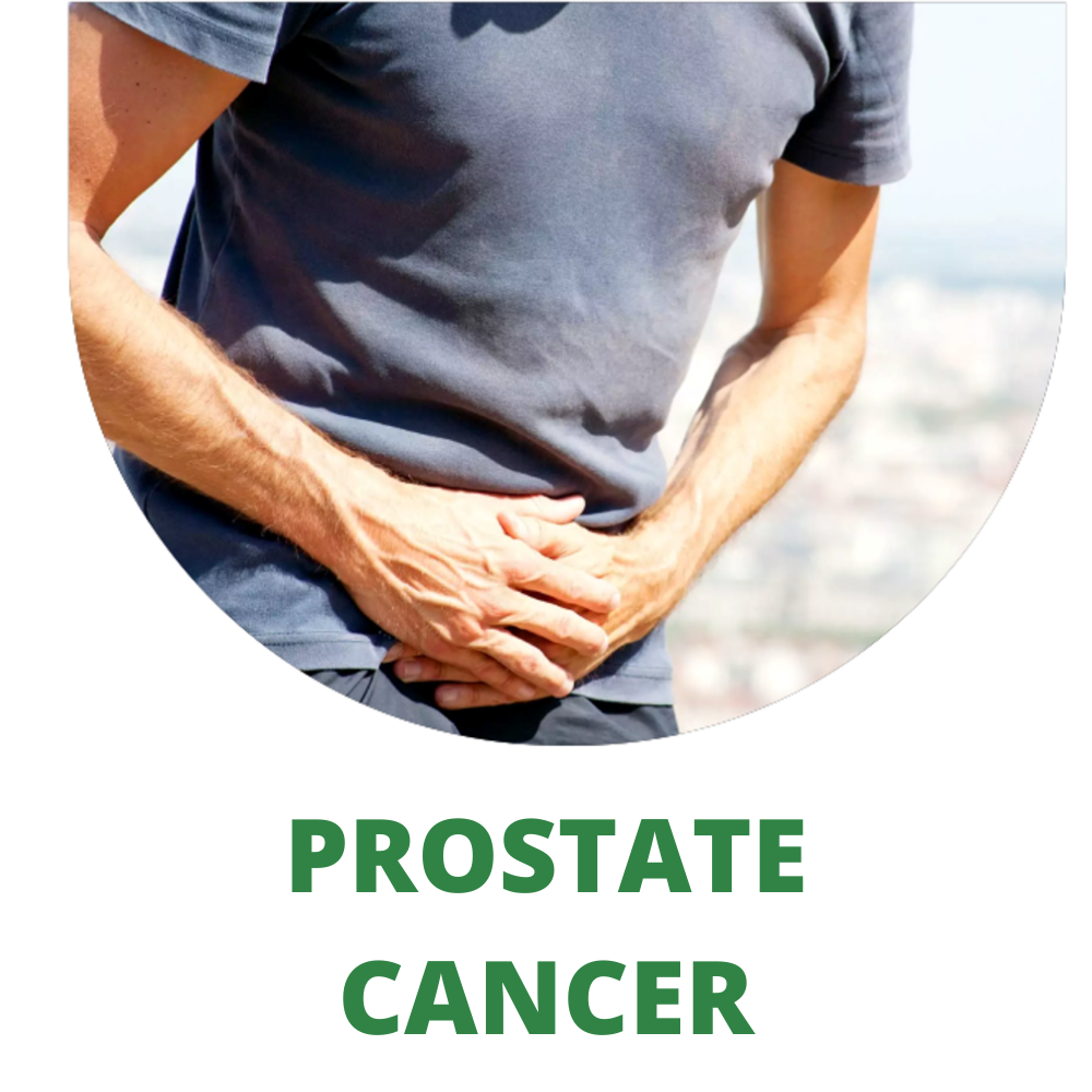 PROSTATE CANCER (2) PROSTATE CANCER (2)