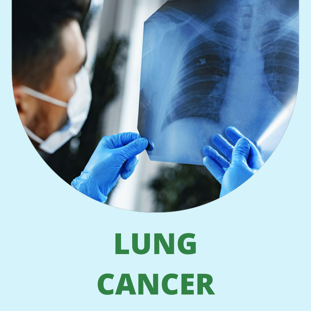 PROSTATE CANCER (3) PROSTATE CANCER (3)