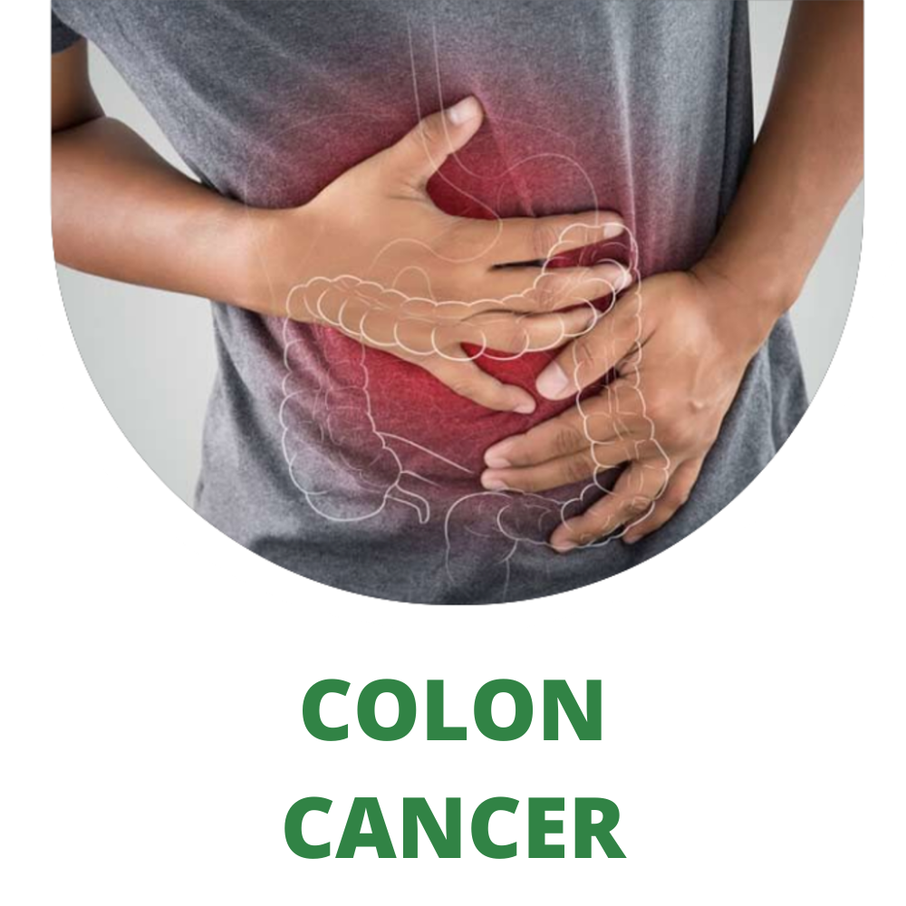 PROSTATE CANCER (4) PROSTATE CANCER (4)